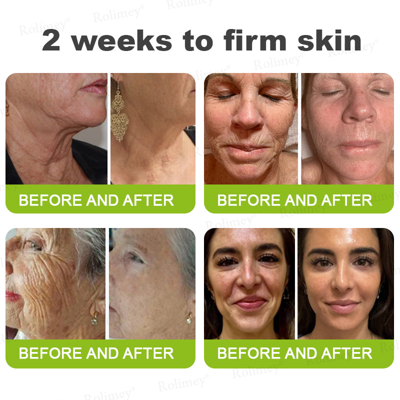 ✅💞Made and shipped from Australia 💫Rolimey® Botox & Vita-A Retinol Shot Wrinkle-Lift Tightening cream - Last Day Promotion 70% OFF