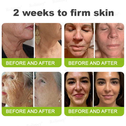 ✅💞Made and shipped from Australia 💫Rolimey® Botox & Vita-A Retinol Shot Wrinkle-Lift Tightening cream - Last Day Promotion 70% OFF