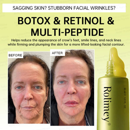 🪄AU HOT SALES🌟Rolimey® Multi-Peptide Retinol Shot Age-Reset Wrinkle-Lift Cream