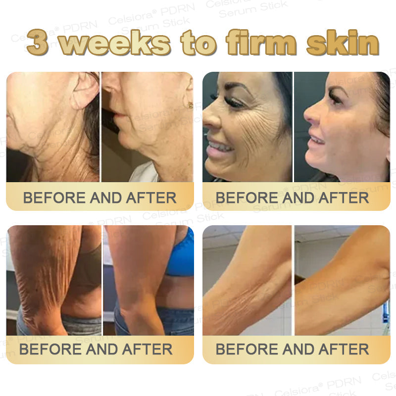 👩‍🔬✨Celsiora® Firming Serum Stick👩‍🔬LAST DAY 70% OFF