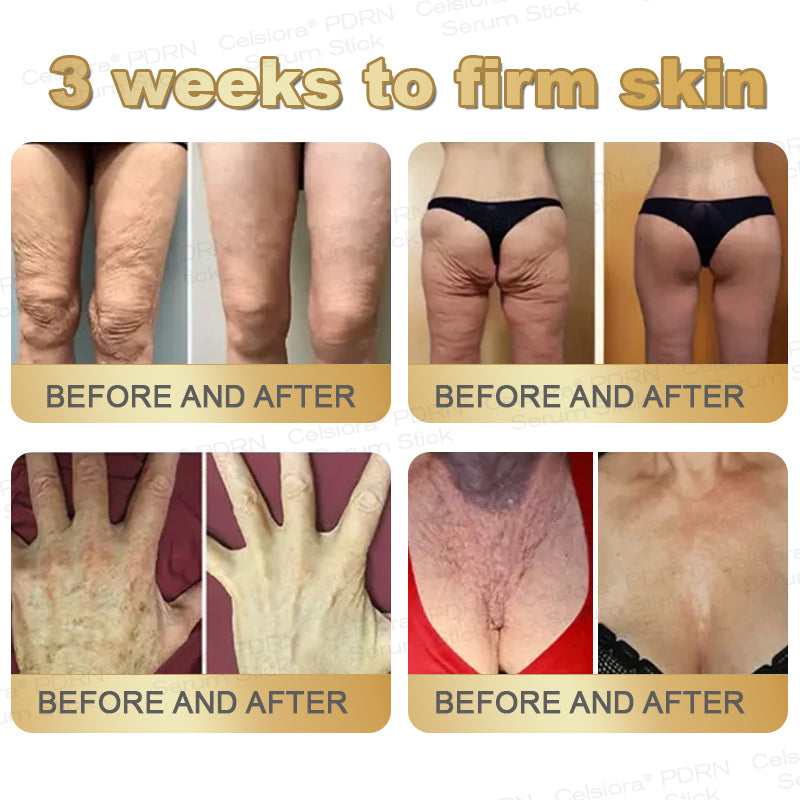 👩‍🔬✨Celsiora® Firming Serum Stick👩‍🔬LAST DAY 70% OFF