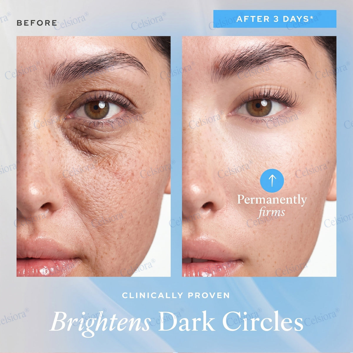 ❤️‍🔥🎀AU HOT SALES 💫Celsiora® Botox & PDRN Anti-Wrinkle Shot – Lift & Firming Cream
