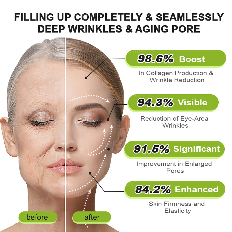 ✅💞Made and shipped from Australia 💫Rolimey® Botox & Vita-A Retinol Shot Wrinkle-Lift Tightening cream - Last Day Promotion 70% OFF
