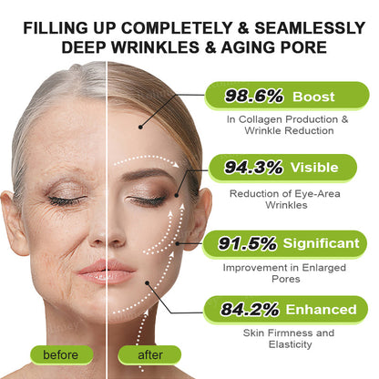 ✅💞Made and shipped from Australia 💫Rolimey® Botox & Vita-A Retinol Shot Wrinkle-Lift Tightening cream - Last Day Promotion 70% OFF