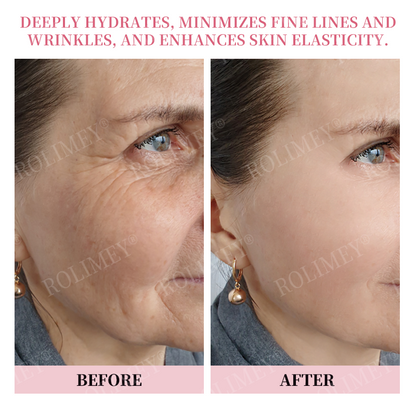 👨‍⚕️🫧Made and Shipped from Australia✅Rolimey®Botox & Stem Cell Firming Anti-Wrinkle Cream Last Day 70% OFF!