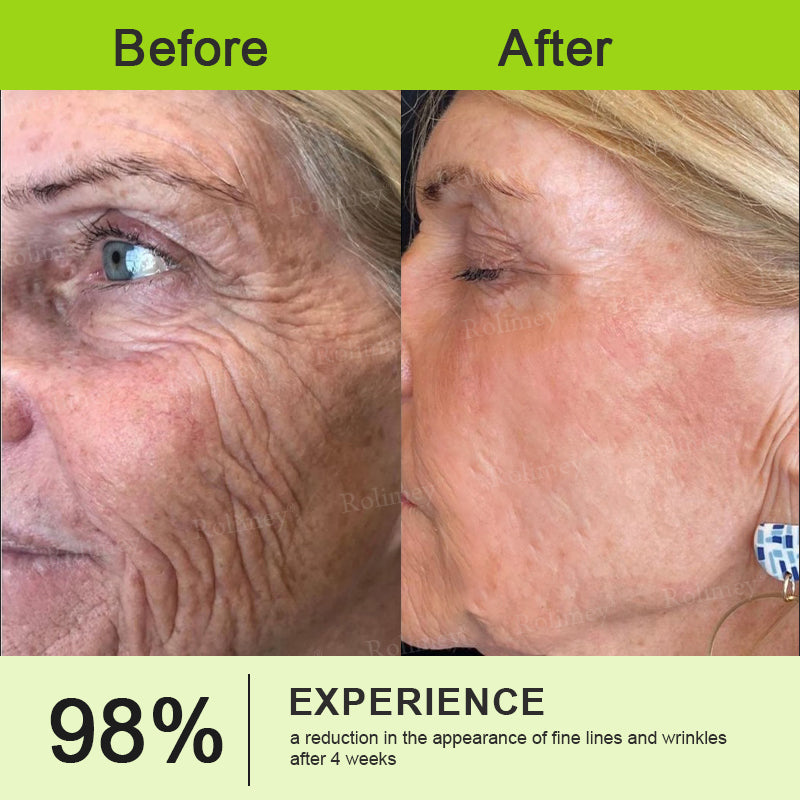 💐👨‍⚕️Made and shipped from the Australia ✅Rolimey® Botox & Vita-A Retinol Shot Wrinkle-Lift Tightening stick- Last Day Promotion 70% OFF