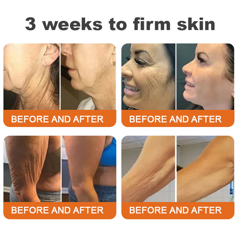 🐝✨Made and Shipped from Australia✨Flysmus™ Botox Bee Venom Firming Serum Stick🔥LAST DAY 70% OFF
