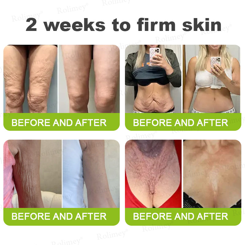 ✅💞Made and shipped from Australia 💫Rolimey® Botox & Vita-A Retinol Shot Wrinkle-Lift Tightening cream - Last Day Promotion 70% OFF