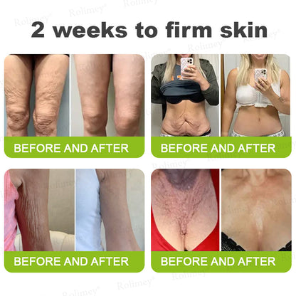 ✅💞Made and shipped from Australia 💫Rolimey® Botox & Vita-A Retinol Shot Wrinkle-Lift Tightening cream - Last Day Promotion 70% OFF