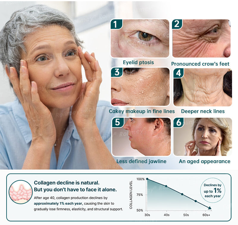 AU HOT SALES ✨Rolimey® Botox & Stem Cell Wrinkle-Lift Tightening Cream