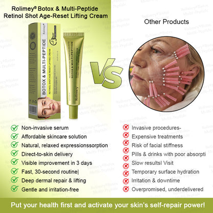 🪄AU HOT SALES🌟Rolimey® Multi-Peptide Retinol Shot Age-Reset Wrinkle-Lift Cream