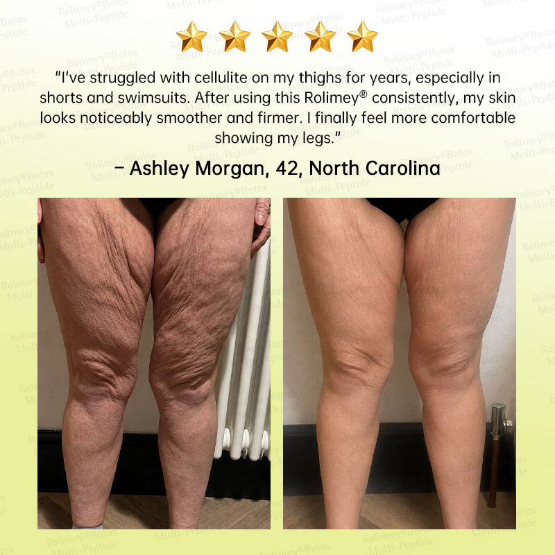 🪄AU HOT SALES🌟Rolimey® Multi-Peptide Retinol Shot Age-Reset Wrinkle-Lift Cream