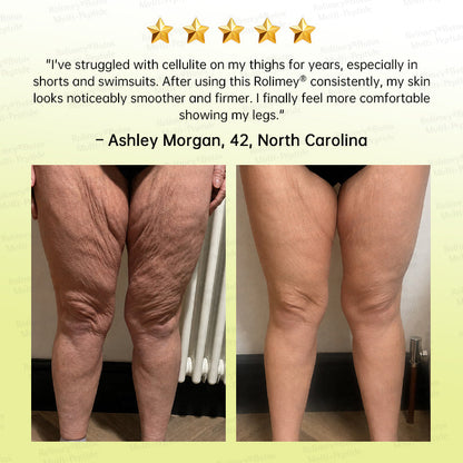🪄AU HOT SALES🌟Rolimey® Multi-Peptide Retinol Shot Age-Reset Wrinkle-Lift Cream