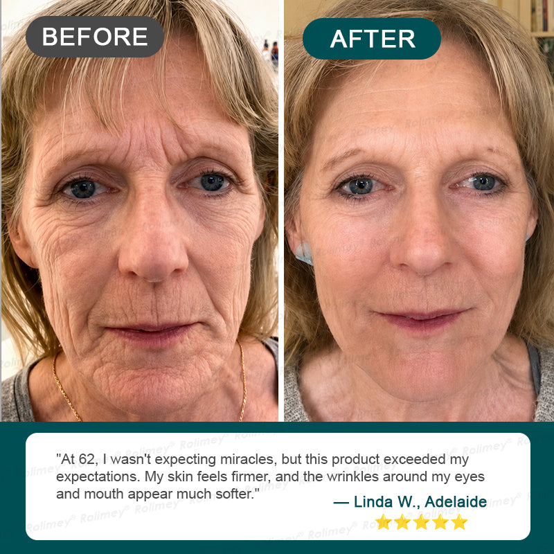 AU HOT SALES ✨Rolimey® Botox & Stem Cell Wrinkle-Lift Tightening Cream