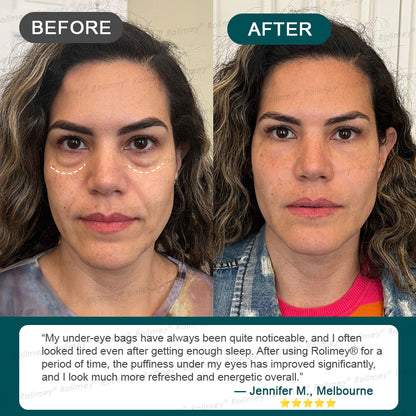 AU HOT SALES ✨Rolimey® Botox & Stem Cell Wrinkle-Lift Tightening Cream