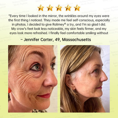 🪄AU HOT SALES🌟Rolimey® Multi-Peptide Retinol Shot Age-Reset Wrinkle-Lift Cream