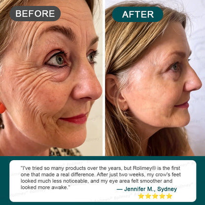 AU HOT SALES ✨Rolimey® Botox & Stem Cell Wrinkle-Lift Tightening Cream