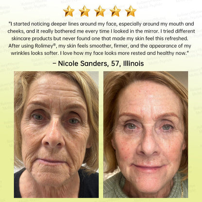 🪄AU HOT SALES🌟Rolimey® Multi-Peptide Retinol Shot Age-Reset Wrinkle-Lift Cream