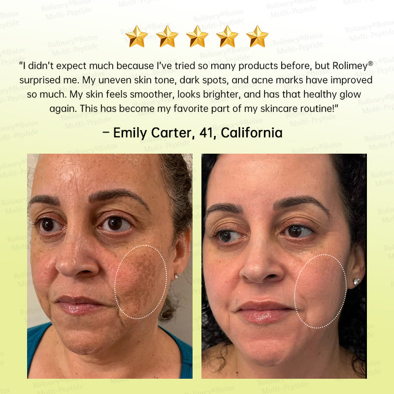 🪄AU HOT SALES🌟Rolimey® Multi-Peptide Retinol Shot Age-Reset Wrinkle-Lift Cream