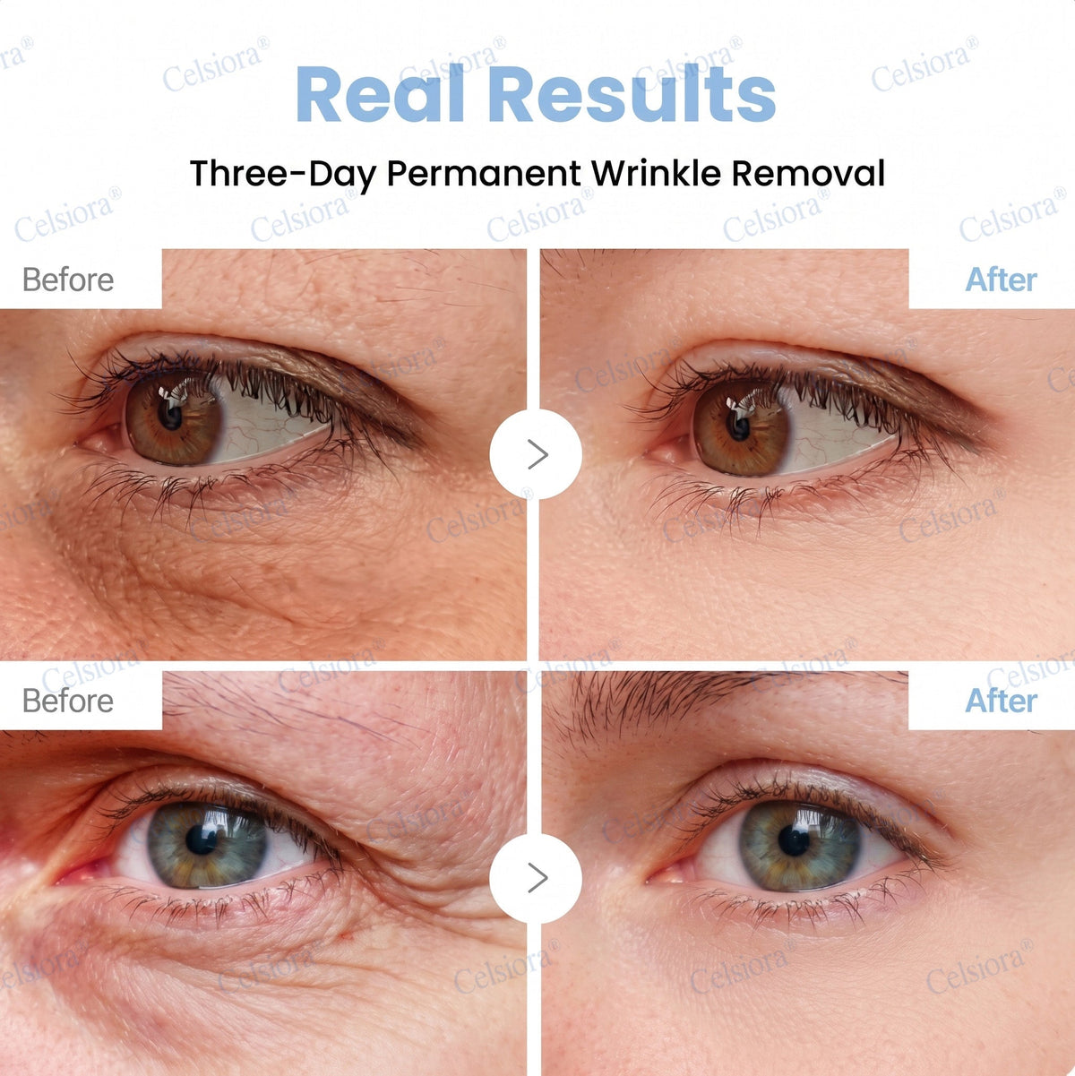 ❤️‍🔥🎀AU HOT SALES 💫Celsiora® Botox & PDRN Anti-Wrinkle Shot – Lift & Firming Cream