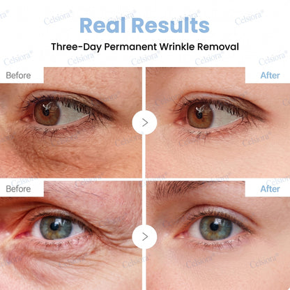 ❤️‍🔥🎀AU HOT SALES 💫Celsiora® Botox & PDRN Anti-Wrinkle Shot – Lift & Firming Cream