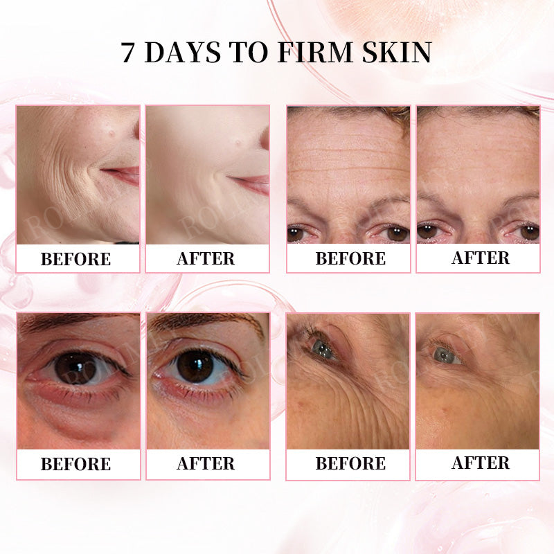 👨‍⚕️🫧Made and Shipped from Australia✅Rolimey®Botox & Stem Cell Firming Anti-Wrinkle Cream Last Day 70% OFF!