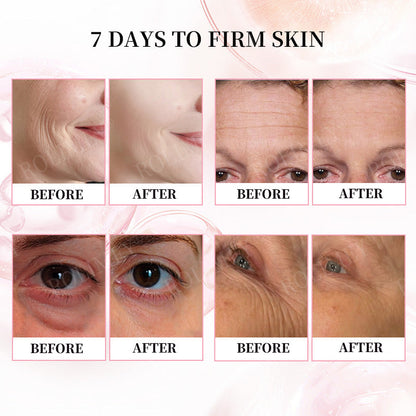 👨‍⚕️🫧Made and Shipped from Australia✅Rolimey®Botox & Stem Cell Firming Anti-Wrinkle Cream Last Day 70% OFF!