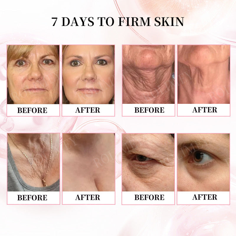 👨‍⚕️🫧Made and Shipped from Australia✅Rolimey®Botox & Stem Cell Firming Anti-Wrinkle Cream Last Day 70% OFF!