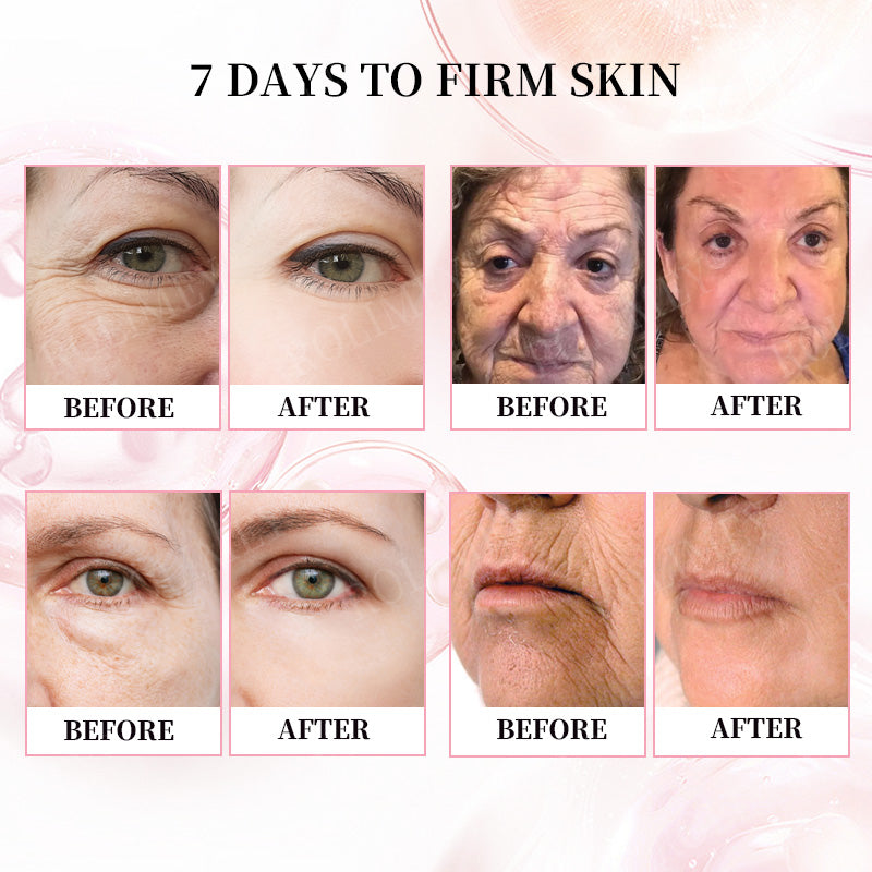 👨‍⚕️🫧Made and Shipped from Australia✅Rolimey®Botox & Stem Cell Firming Anti-Wrinkle Cream Last Day 70% OFF!