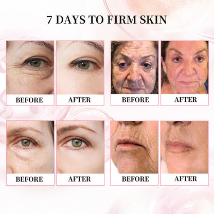 👨‍⚕️🫧Made and Shipped from Australia✅Rolimey®Botox & Stem Cell Firming Anti-Wrinkle Cream Last Day 70% OFF!