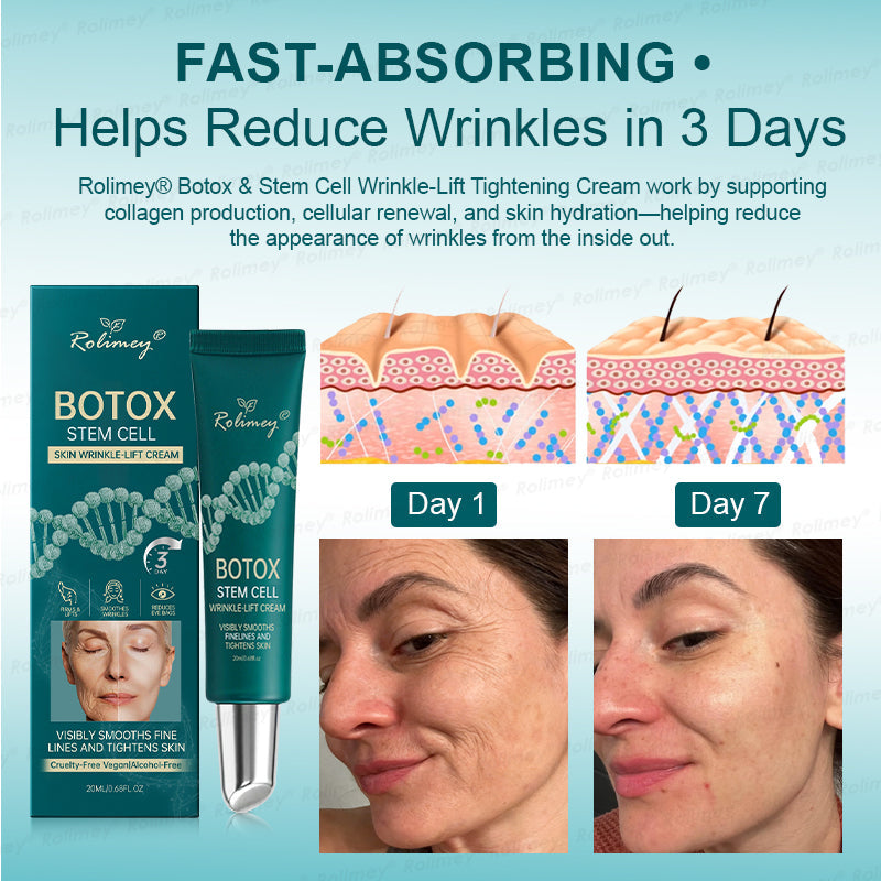 AU HOT SALES ✨Rolimey® Botox & Stem Cell Wrinkle-Lift Tightening Cream