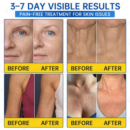 ❤️‍🔥🎀AU HOT SALES 💫Celsiora® Botox & PDRN Anti-Wrinkle Shot – Lift & Firming Cream