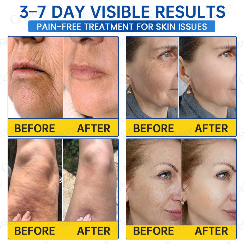 ❤️‍🔥🎀AU HOT SALES 💫Celsiora® Botox & PDRN Anti-Wrinkle Shot – Lift & Firming Cream