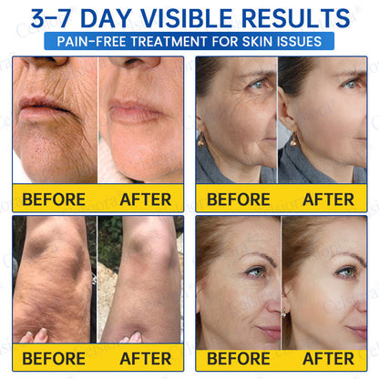 ❤️‍🔥🎀AU HOT SALES 💫Celsiora® Botox & PDRN Anti-Wrinkle Shot – Lift & Firming Cream