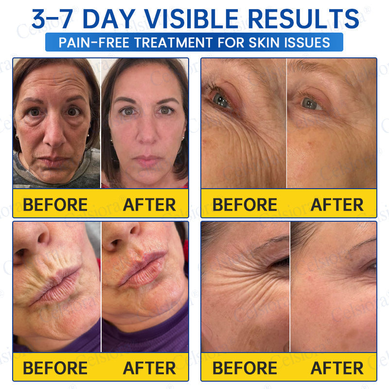 ❤️‍🔥🎀AU HOT SALES 💫Celsiora® Botox & PDRN Anti-Wrinkle Shot – Lift & Firming Cream