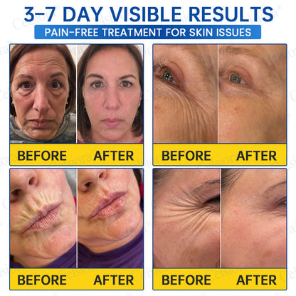 ❤️‍🔥🎀AU HOT SALES 💫Celsiora® Botox & PDRN Anti-Wrinkle Shot – Lift & Firming Cream