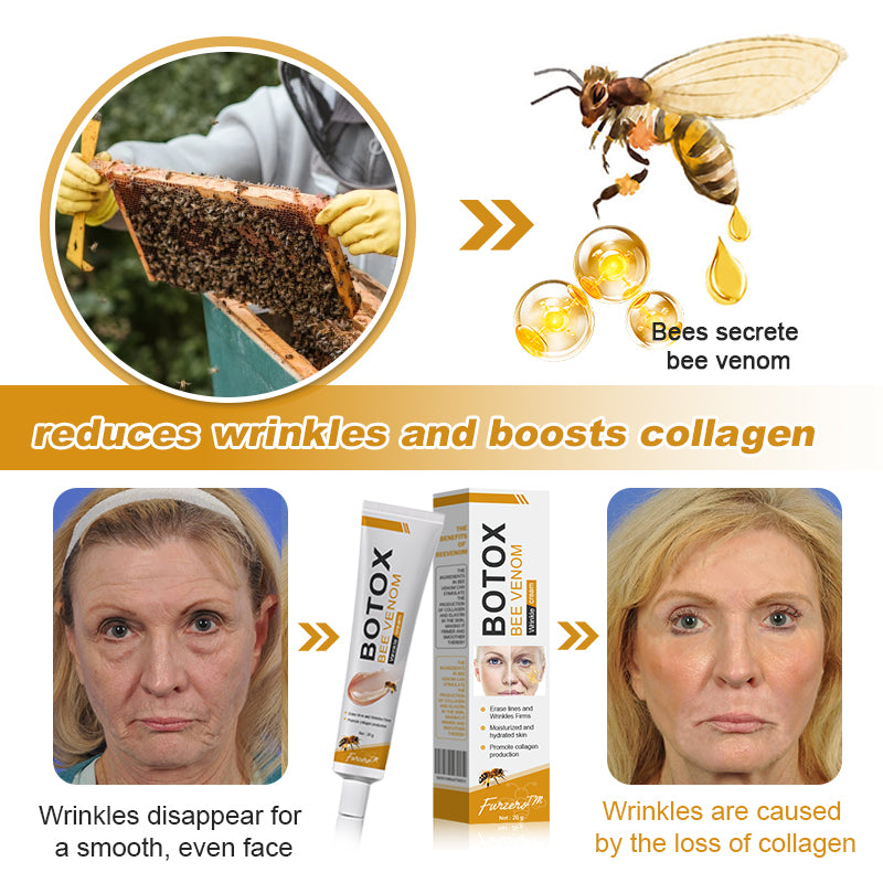 💛👨‍⚕️Made and Shipped from Australia✅ Furzero™ Botox Bee Venom Wrinkle Removal Cream- LAST DAY 70% OFF