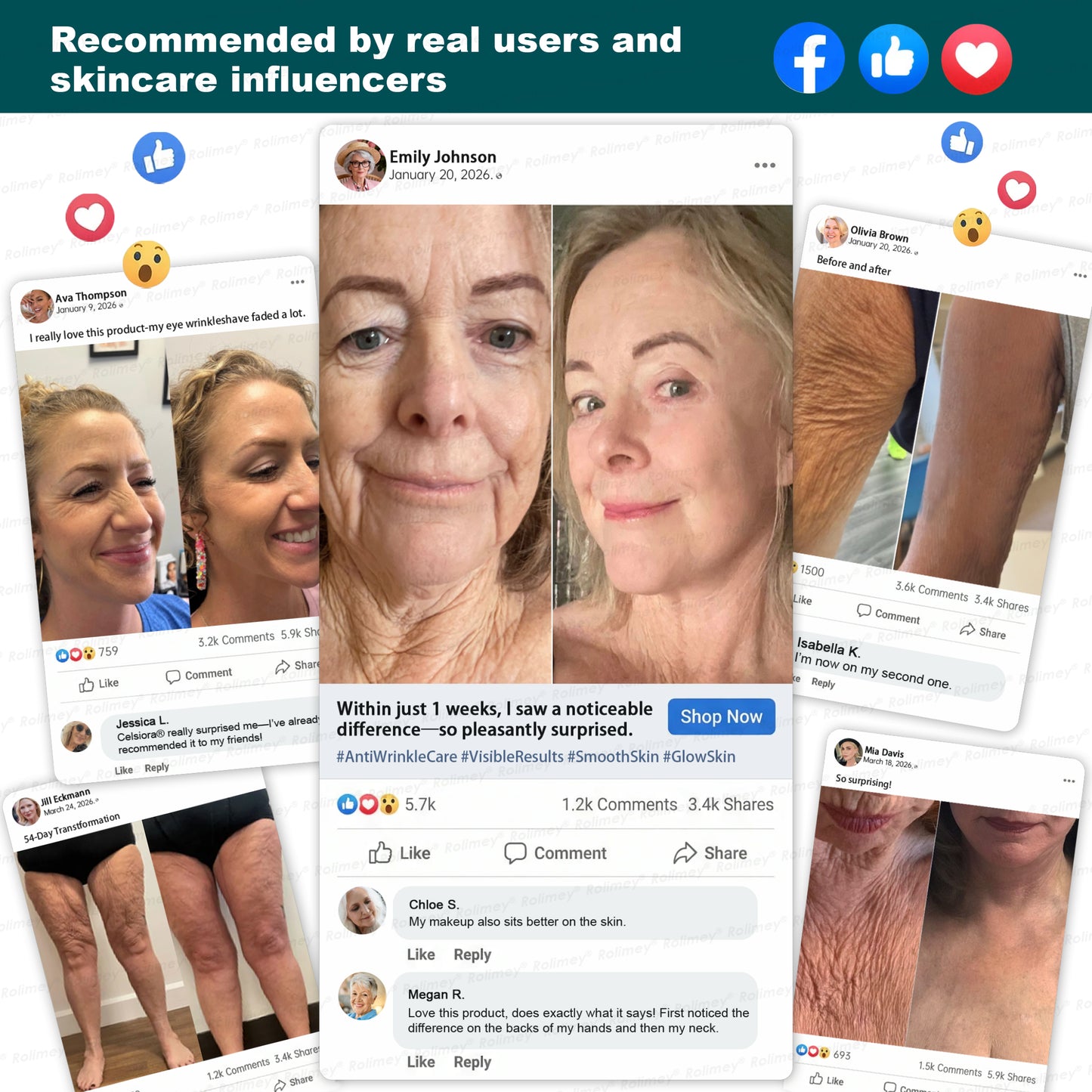 🔥💛AU HOT SALES ✨Rolimey® Botox & Stem Cell Wrinkle-Lift Tightening Cream