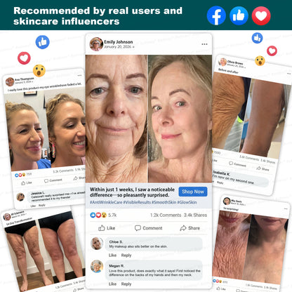 🔥💛AU HOT SALES ✨Rolimey® Botox & Stem Cell Wrinkle-Lift Tightening Cream