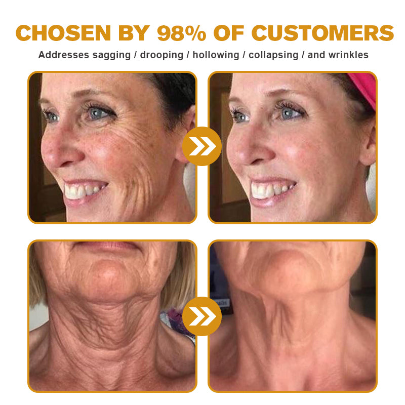 💛👨‍⚕️Made and Shipped from Australia✅ Furzero™ Botox Bee Venom Wrinkle Removal Cream- LAST DAY 70% OFF