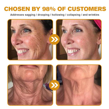 💛👨‍⚕️Made and Shipped from Australia✅ Furzero™ Botox Bee Venom Wrinkle Removal Cream- LAST DAY 70% OFF