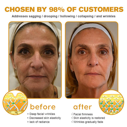 💛👨‍⚕️Made and Shipped from Australia✅ Furzero™ Botox Bee Venom Wrinkle Removal Cream- LAST DAY 70% OFF